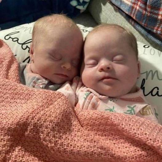 Mom of rare twins with Down syndrome show how beautiful and precious they are to shut down critics